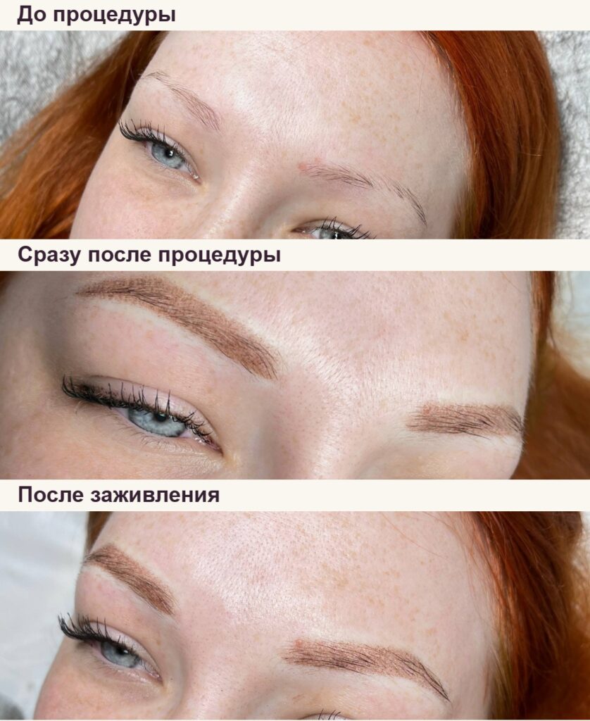 Брови: до процедуры, сразу после и после заживления